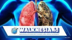 Kasus Kanker Paru Meningkat pada Non-Perokok, Polusi Udara Diduga Jadi Pemicu