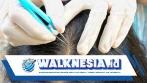 Cara Efektif Mengatasi Rambut Beruban di Usia Muda