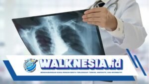 Kenali Orang-orang yang Berisiko Tinggi Tertular TBC, Siapa Saja?