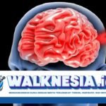 Kenapa Penyumbatan Pembuluh Darah di Leher dan Otak Berbahaya? Ini Penjelasannya