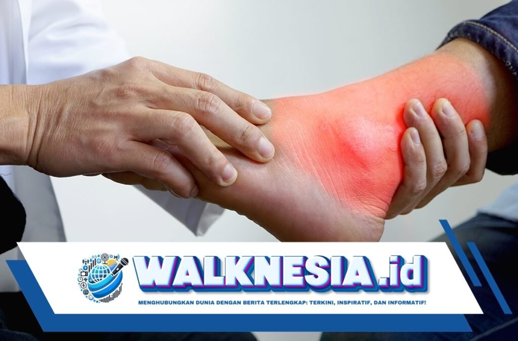 Normalnya Asam Urat Berapa? Berikut Penjelasannya