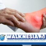 Normalnya Asam Urat Berapa? Berikut Penjelasannya