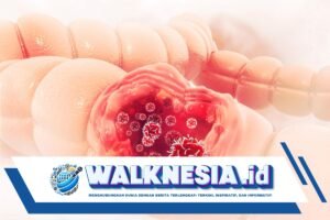 Kenali Gejala Kanker Kolorektal yang Meningkat di Kalangan Gen Z