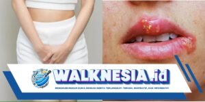 kenali tanda-tanda sifilis pada wanita sebelum terlambat