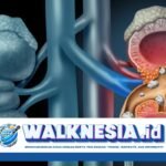 Mengenal Apa Itu Batu Ginjal: Penyebab, Gejala, dan Pengobatannya