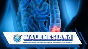 Apa Itu Kanker Kolorektal? Ini Gejala, Penyebab, dan Cara Mencegahnya